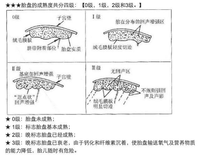 胎盘成熟度2级图片