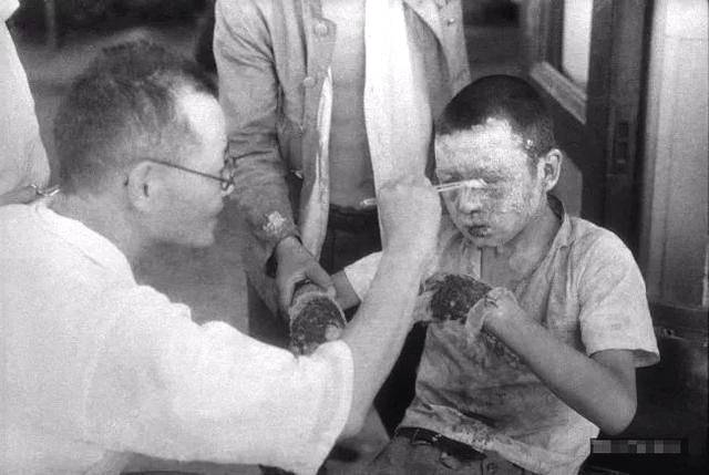 老照片原子弹爆炸三天后的广岛幸存者大多面目全非